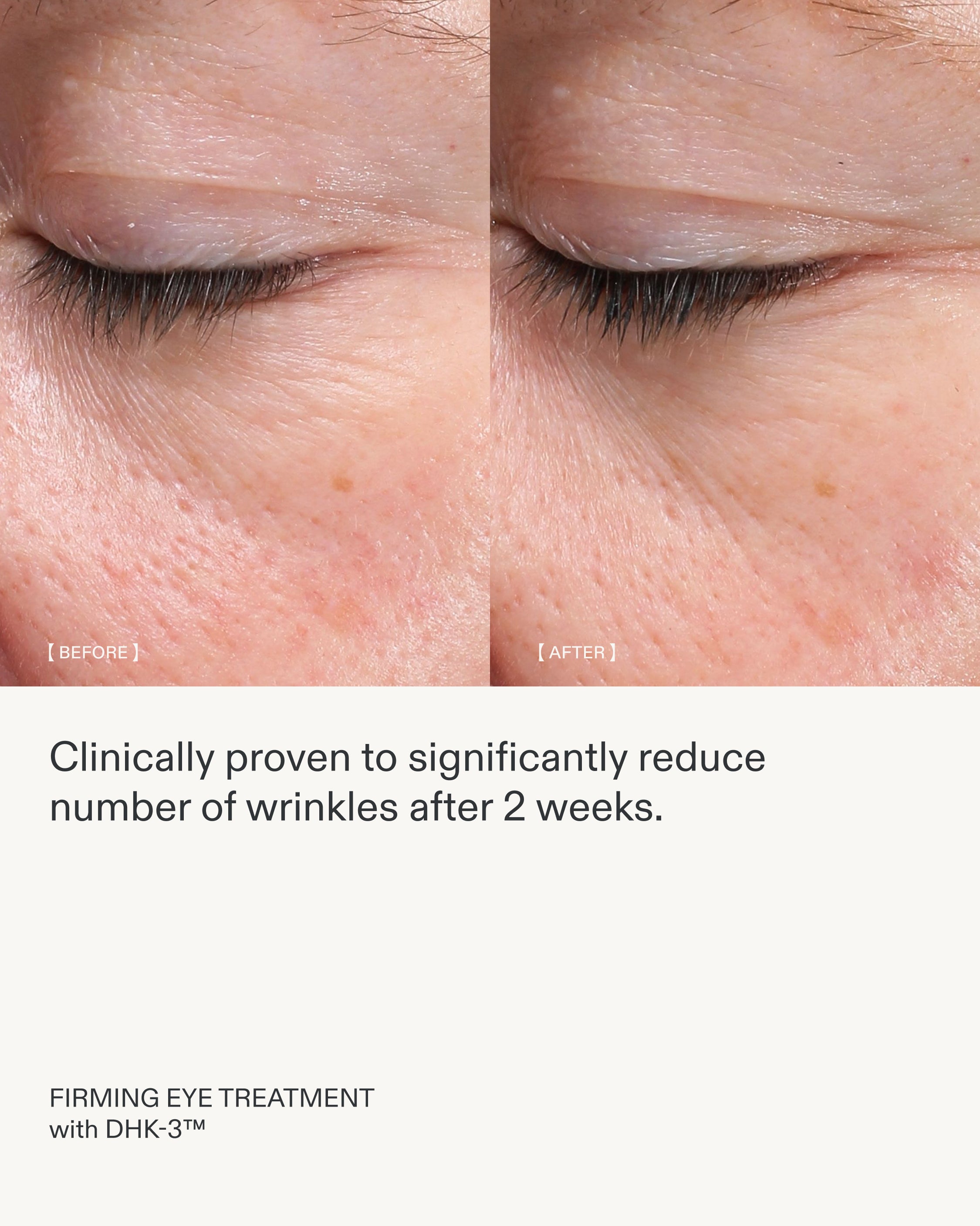 FIRMING EYE TREATMENT | Activated Gel-Crème – REOME