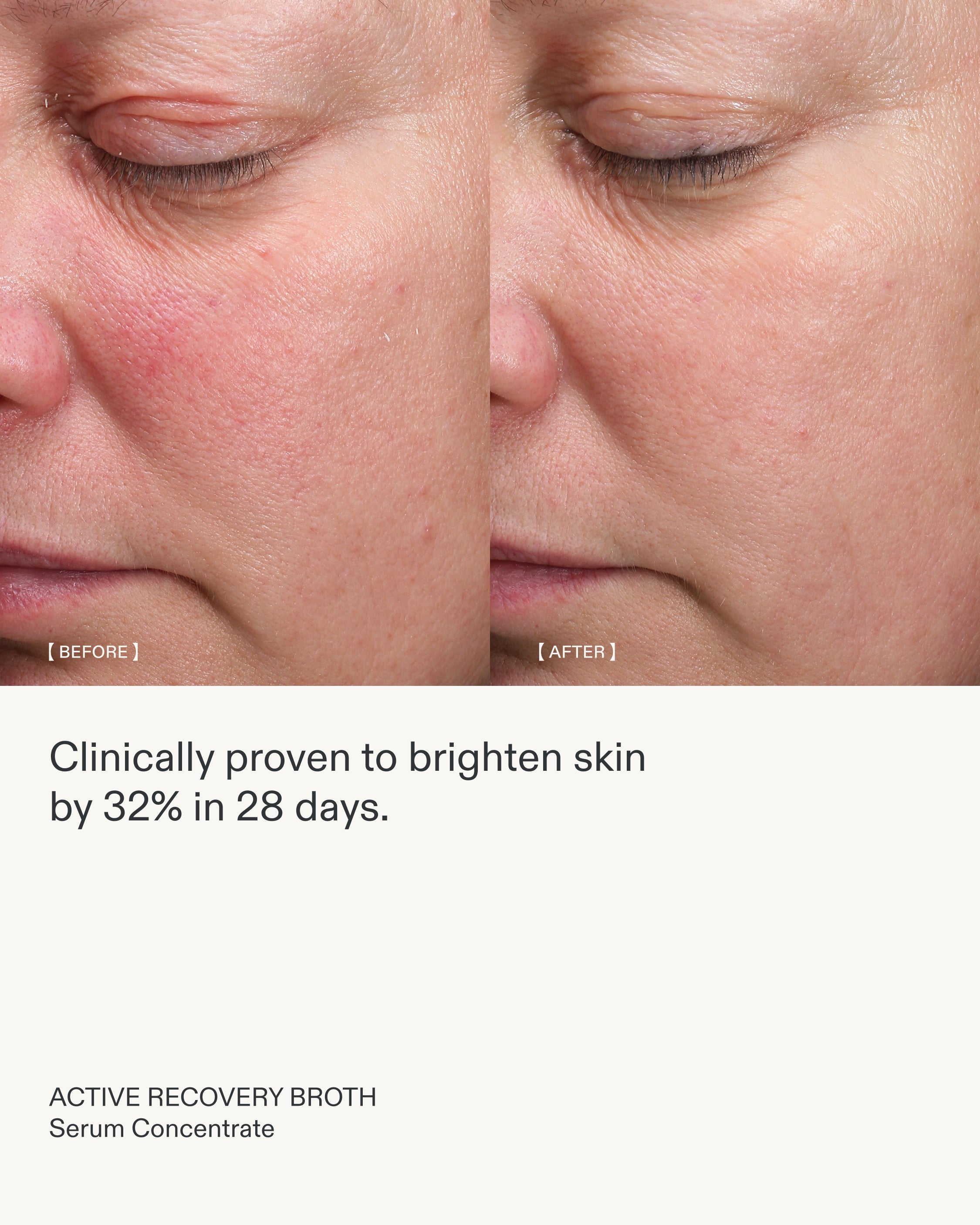 美容液 reo. ACTIVE RECOVERY BROTH | Concentrated Facial Serum – REOME